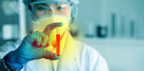 Scientist holding a test tube with red liquid in a laboratory setting